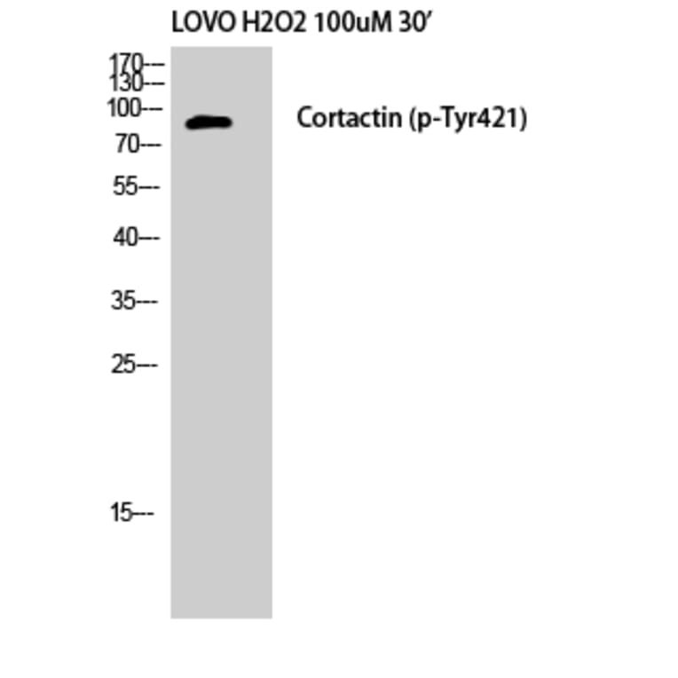 Western Blot - Anti-Cortactin (phospho Tyr421) Antibody (A7049) - Antibodies.com