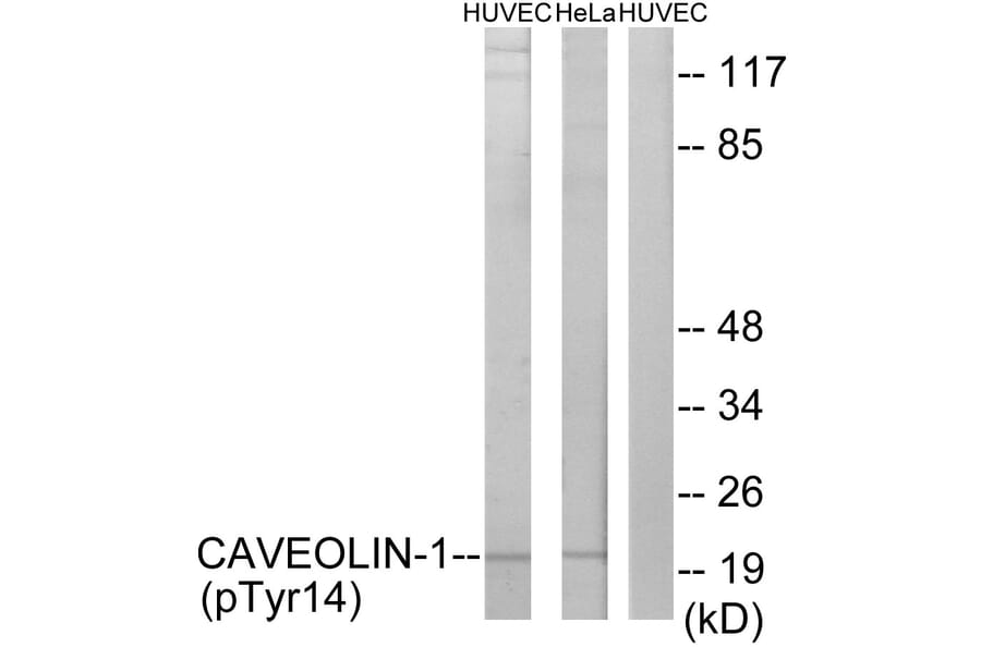 Western Blot - Anti-Caveolin-1 (phospho Tyr14) Antibody (A7034) - Antibodies.com