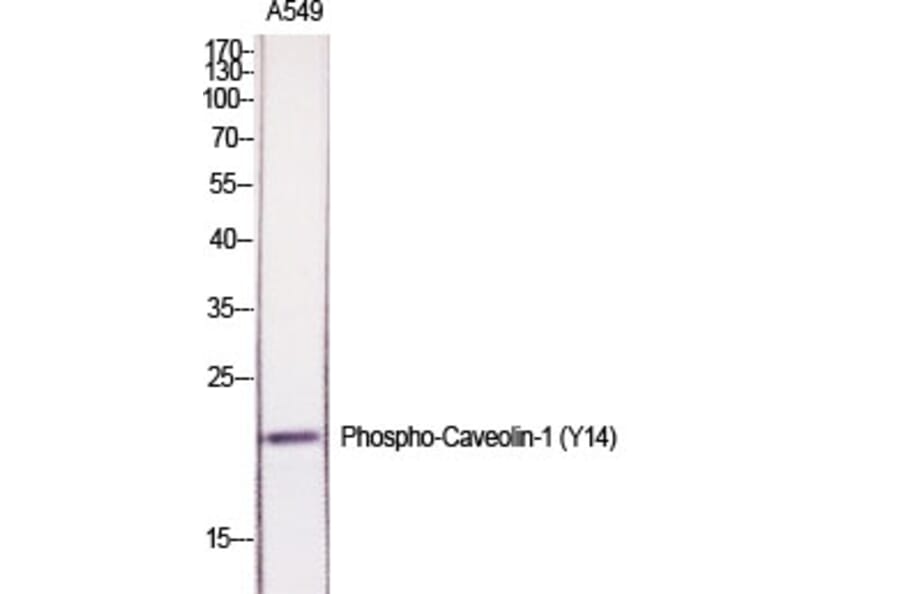 Western Blot - Anti-Caveolin-1 (phospho Tyr14) Antibody (A7034) - Antibodies.com