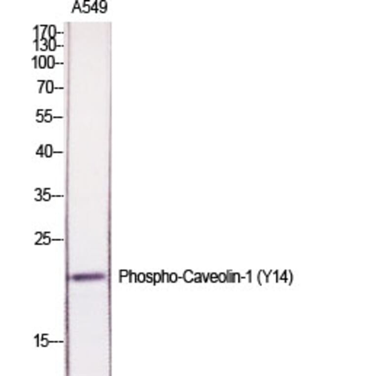 Western Blot - Anti-Caveolin-1 (phospho Tyr14) Antibody (A7034) - Antibodies.com