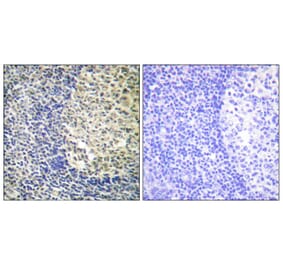 Immunohistochemistry - Anti-p47 phox (phospho Ser370) Antibody (A1171) - Antibodies.com