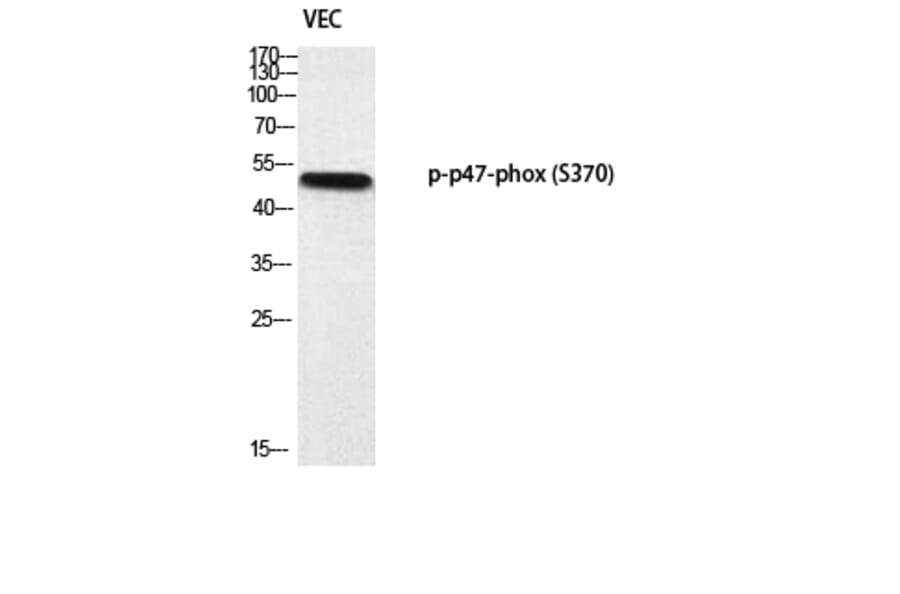 Western Blot - Anti-p47 phox (phospho Ser370) Antibody (A1171) - Antibodies.com