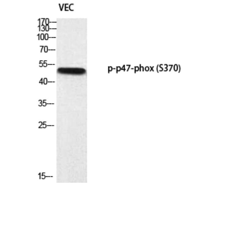 Western Blot - Anti-p47 phox (phospho Ser370) Antibody (A1171) - Antibodies.com