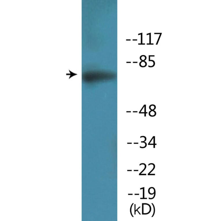 Western Blot - Anti-Artemis (phospho Ser516) Antibody (P12-1076) - Antibodies.com
