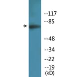 Western Blot - Anti-Artemis (phospho Ser516) Antibody (P12-1076) - Antibodies.com