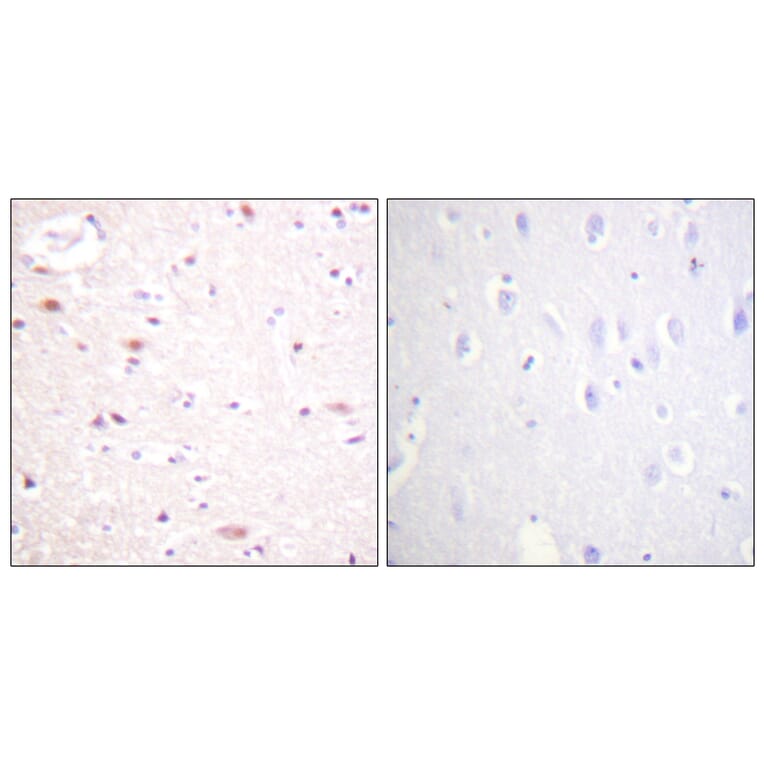 Immunohistochemistry - Anti-CDC16 (phospho Ser560) Antibody (A1027) - Antibodies.com