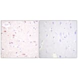 Immunohistochemistry - Anti-CDC16 (phospho Ser560) Antibody (A1027) - Antibodies.com
