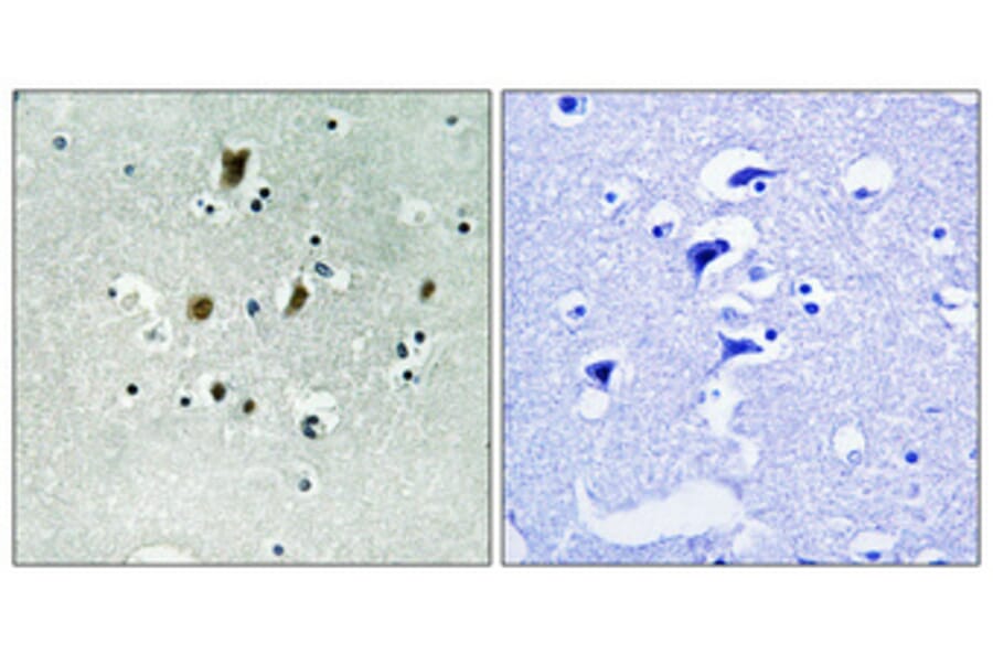 Immunohistochemistry - Anti-CDC16 (phospho Ser560) Antibody (A1027) - Antibodies.com