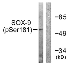 Western Blot - Anti-SOX-9 (phospho Ser181) Antibody (A0576) - Antibodies.com