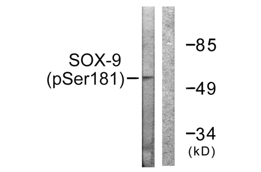 Western Blot - Anti-SOX-9 (phospho Ser181) Antibody (A0576) - Antibodies.com