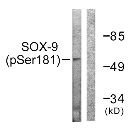 Western Blot - Anti-SOX-9 (phospho Ser181) Antibody (A0576) - Antibodies.com