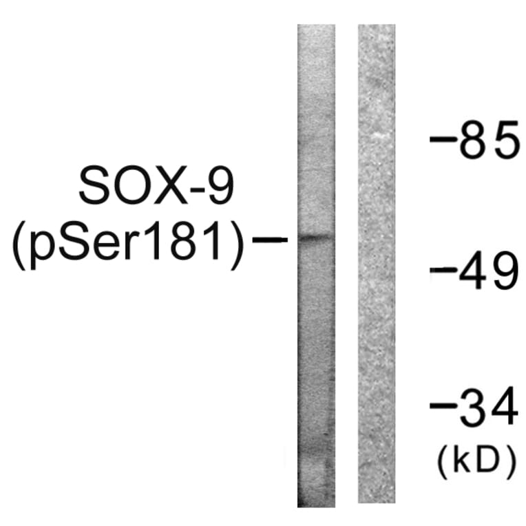 Western Blot - Anti-SOX-9 (phospho Ser181) Antibody (A0576) - Antibodies.com