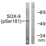 Western Blot - Anti-SOX-9 (phospho Ser181) Antibody (A0576) - Antibodies.com