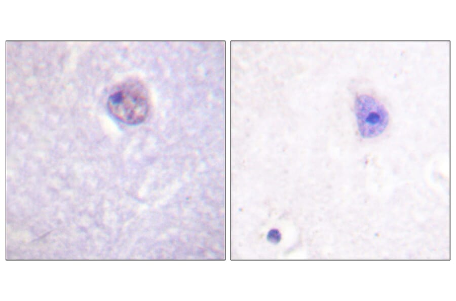 Immunohistochemistry - Anti-SOX-9 (phospho Ser181) Antibody (A0576) - Antibodies.com