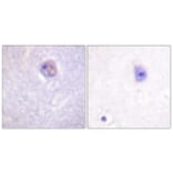 Immunohistochemistry - Anti-SOX-9 (phospho Ser181) Antibody (A0576) - Antibodies.com