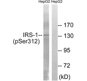 Western Blot - Anti-IRS-1 (phospho Ser312) Antibody (A7121) - Antibodies.com