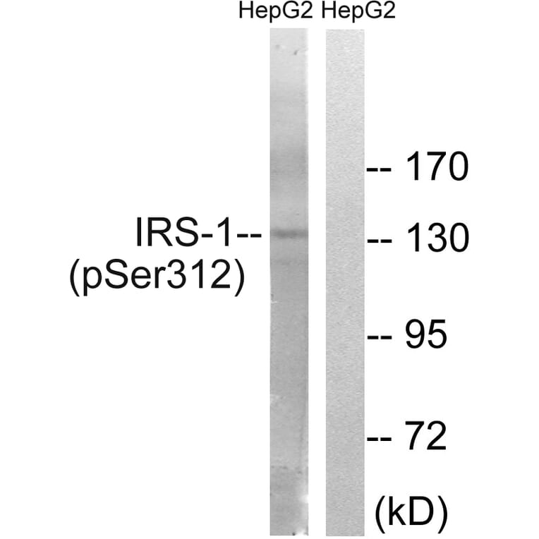 Western Blot - Anti-IRS-1 (phospho Ser312) Antibody (A7121) - Antibodies.com