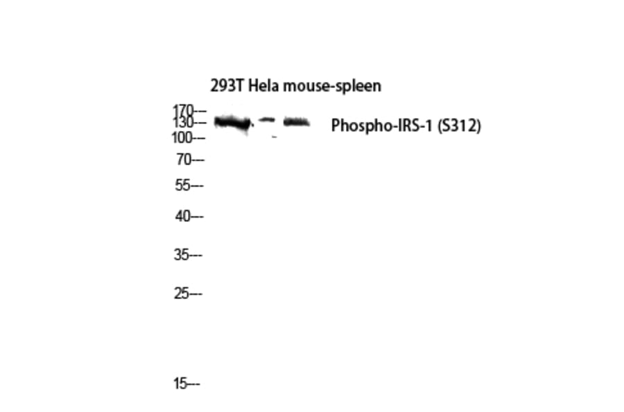 Western Blot - Anti-IRS-1 (phospho Ser312) Antibody (A7121) - Antibodies.com