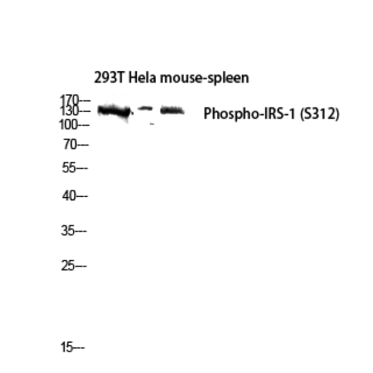 Western Blot - Anti-IRS-1 (phospho Ser312) Antibody (A7121) - Antibodies.com