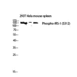 Western Blot - Anti-IRS-1 (phospho Ser312) Antibody (A7121) - Antibodies.com