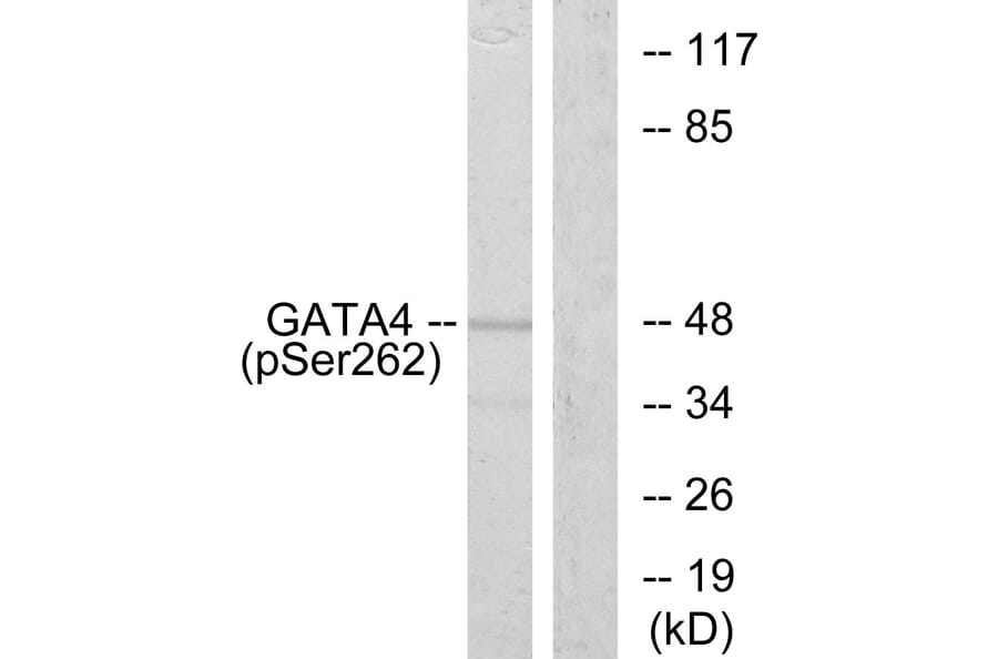Western Blot - Anti-GATA4 (phospho Ser262) Antibody (A0934) - Antibodies.com