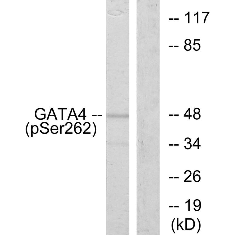 Western Blot - Anti-GATA4 (phospho Ser262) Antibody (A0934) - Antibodies.com