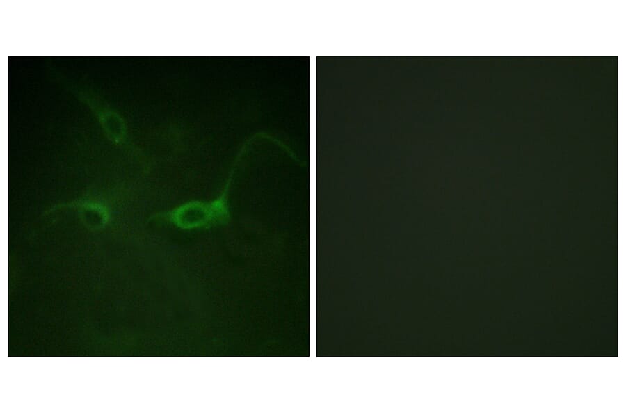Immunofluorescence - Anti-FGFR1 (phospho Tyr654) Antibody (A0481) - Antibodies.com
