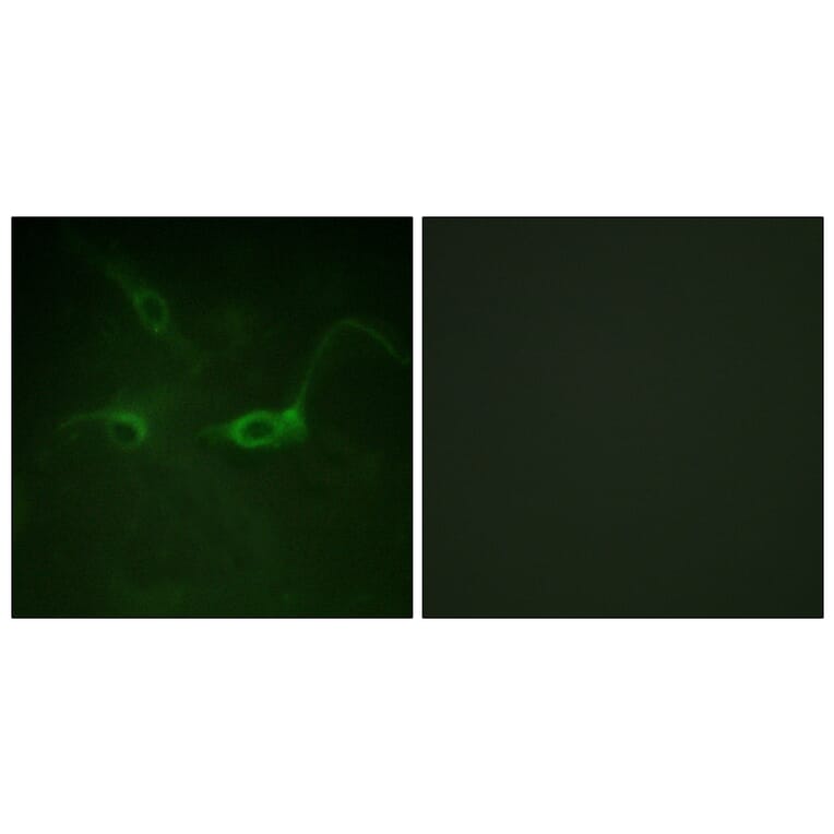 Immunofluorescence - Anti-FGFR1 (phospho Tyr654) Antibody (A0481) - Antibodies.com