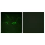 Immunofluorescence - Anti-FGFR1 (phospho Tyr654) Antibody (A0481) - Antibodies.com