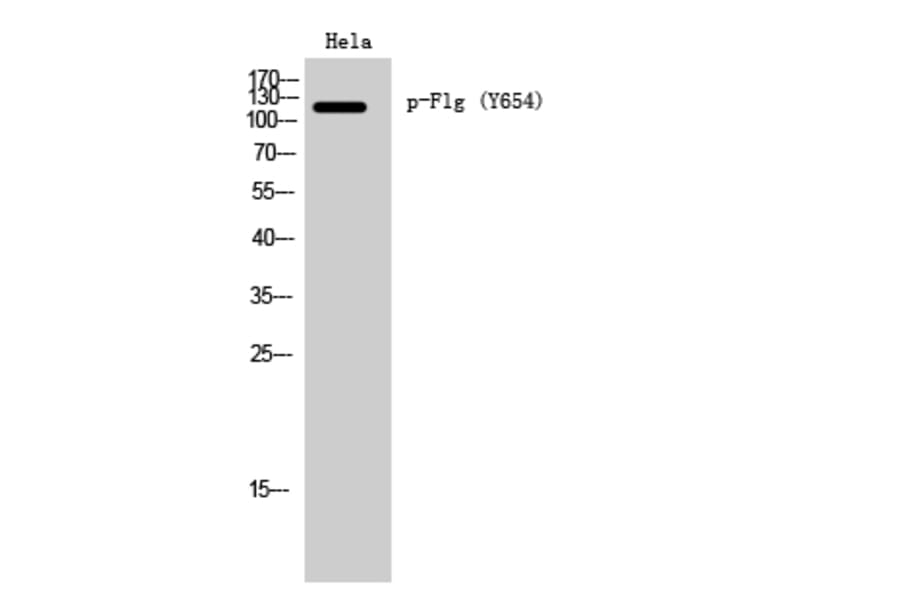 Western Blot - Anti-FGFR1 (phospho Tyr654) Antibody (A0481) - Antibodies.com
