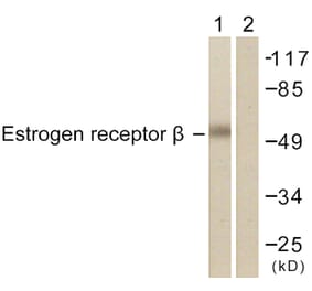 Western Blot - Anti-Estrogen Receptor-beta Antibody (B0922) - Antibodies.com