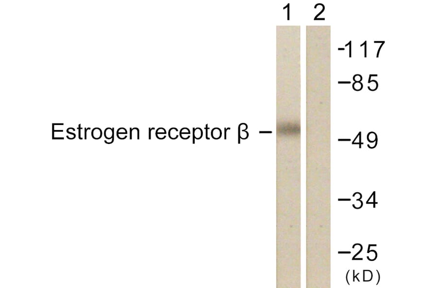 Western Blot - Anti-Estrogen Receptor-beta Antibody (B0922) - Antibodies.com