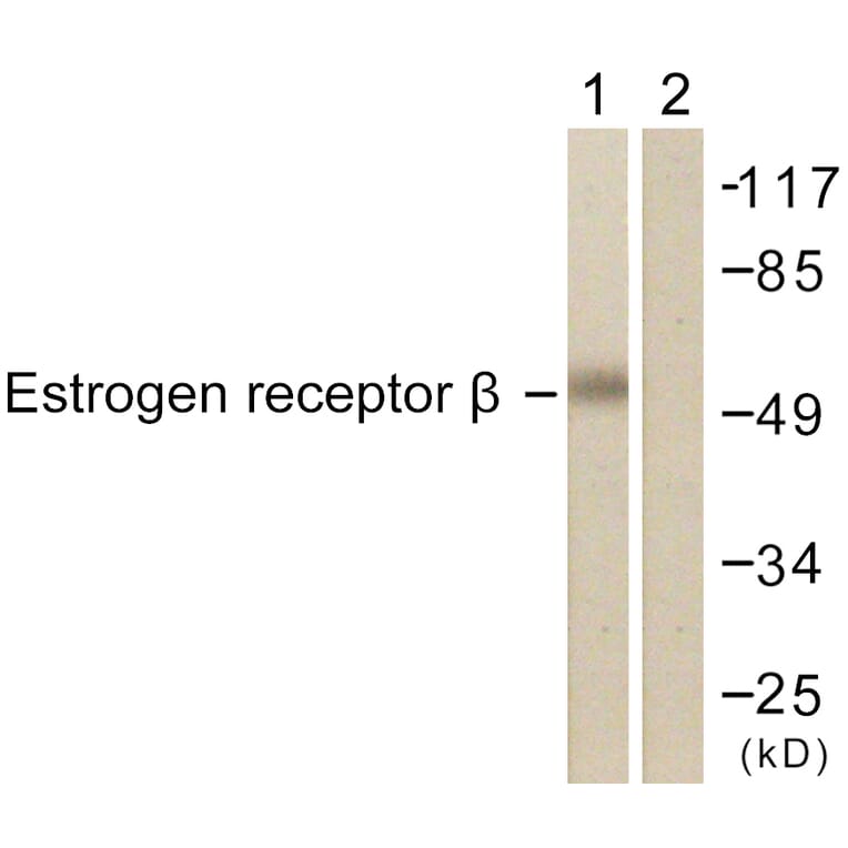 Western Blot - Anti-Estrogen Receptor-beta Antibody (B0922) - Antibodies.com