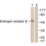 Western Blot - Anti-Estrogen Receptor-beta Antibody (B0922) - Antibodies.com