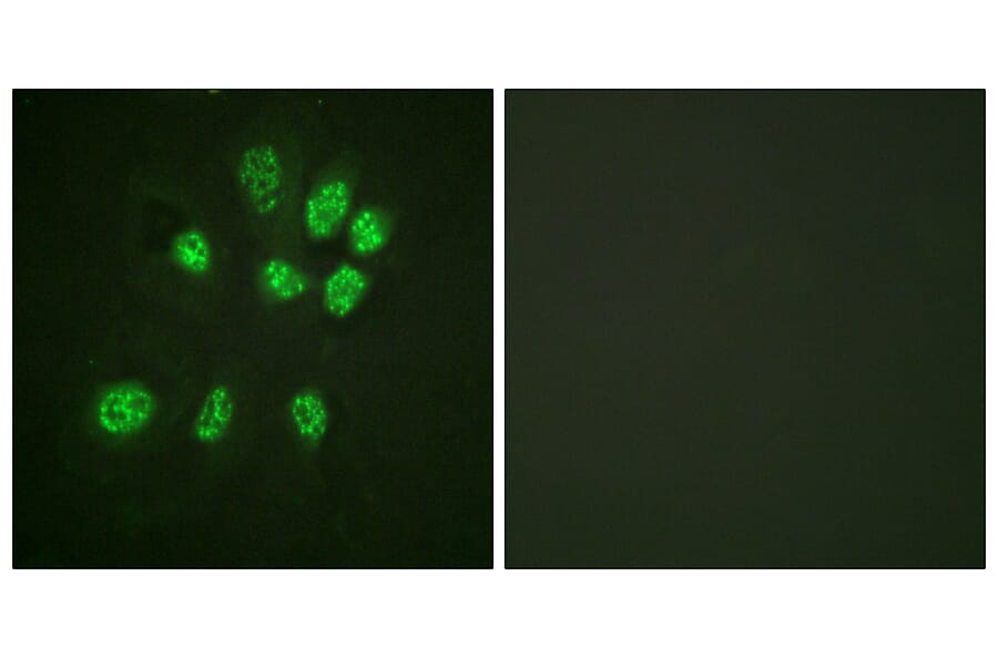 Immunofluorescence - Anti-Estrogen Receptor-beta Antibody (B0922) - Antibodies.com