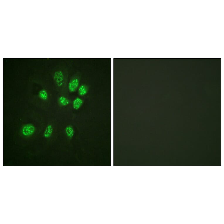 Immunofluorescence - Anti-Estrogen Receptor-beta Antibody (B0922) - Antibodies.com