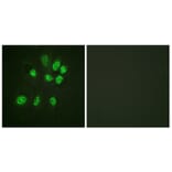 Immunofluorescence - Anti-Estrogen Receptor-beta Antibody (B0922) - Antibodies.com