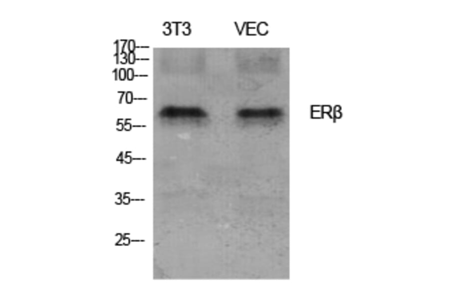 Western Blot - Anti-Estrogen Receptor-beta Antibody (B0922) - Antibodies.com