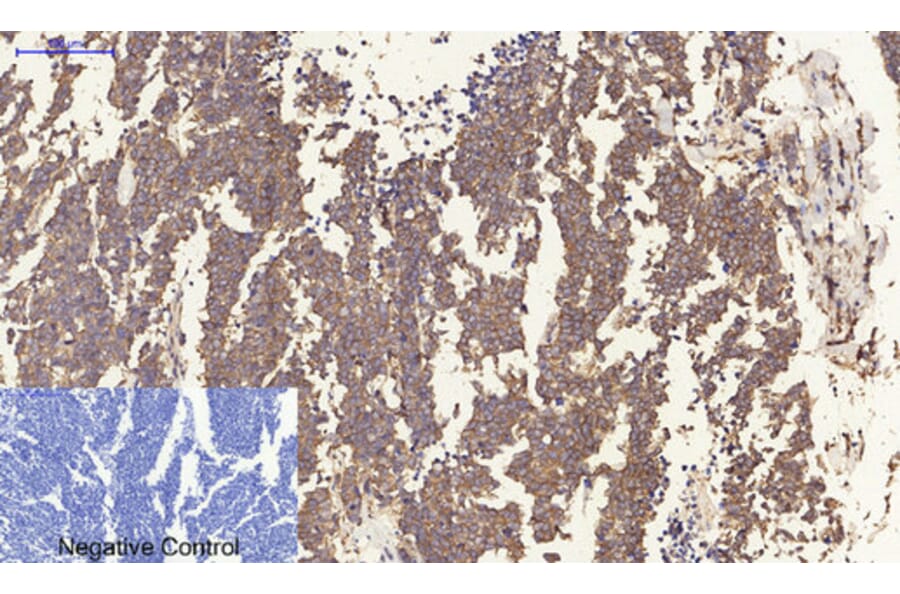 Immunohistochemistry - Anti-Estrogen Receptor-beta Antibody (B0922) - Antibodies.com