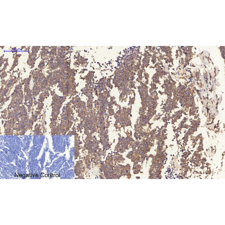 Immunohistochemistry - Anti-Estrogen Receptor-beta Antibody (B0922) - Antibodies.com