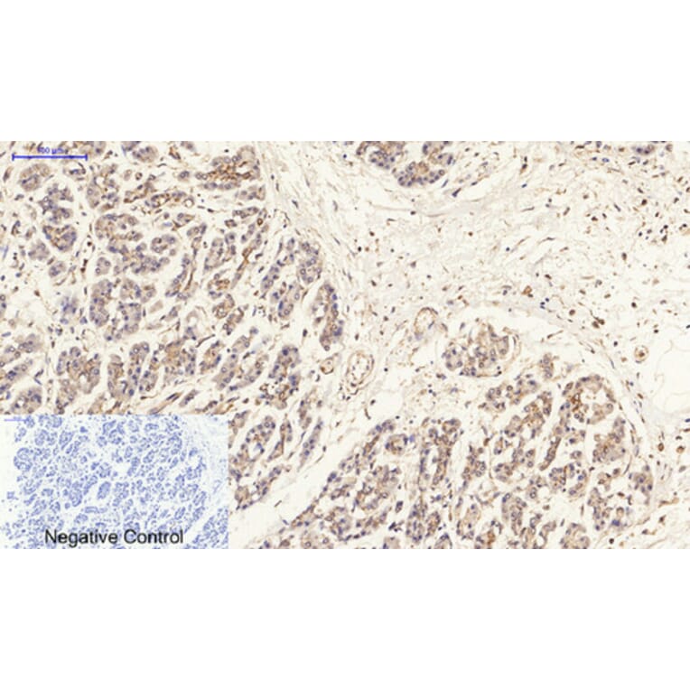 Immunohistochemistry - Anti-Estrogen Receptor-beta Antibody (B0922) - Antibodies.com