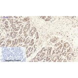 Immunohistochemistry - Anti-Estrogen Receptor-beta Antibody (B0922) - Antibodies.com
