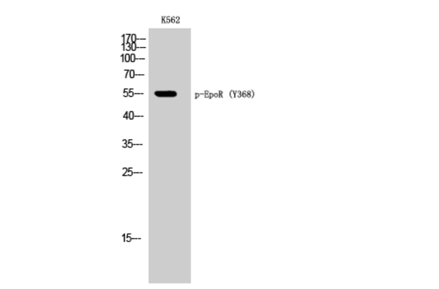 Western Blot - Anti-Epo-R (phospho Tyr368) Antibody (A0917) - Antibodies.com