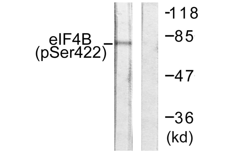 Western Blot - Anti-eIF4B (phospho Ser422) Antibody (A0641) - Antibodies.com