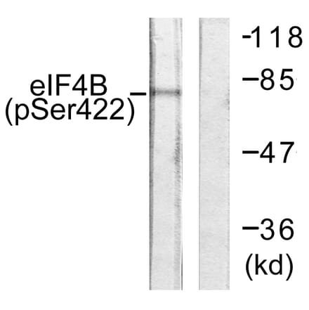 Western Blot - Anti-eIF4B (phospho Ser422) Antibody (A0641) - Antibodies.com