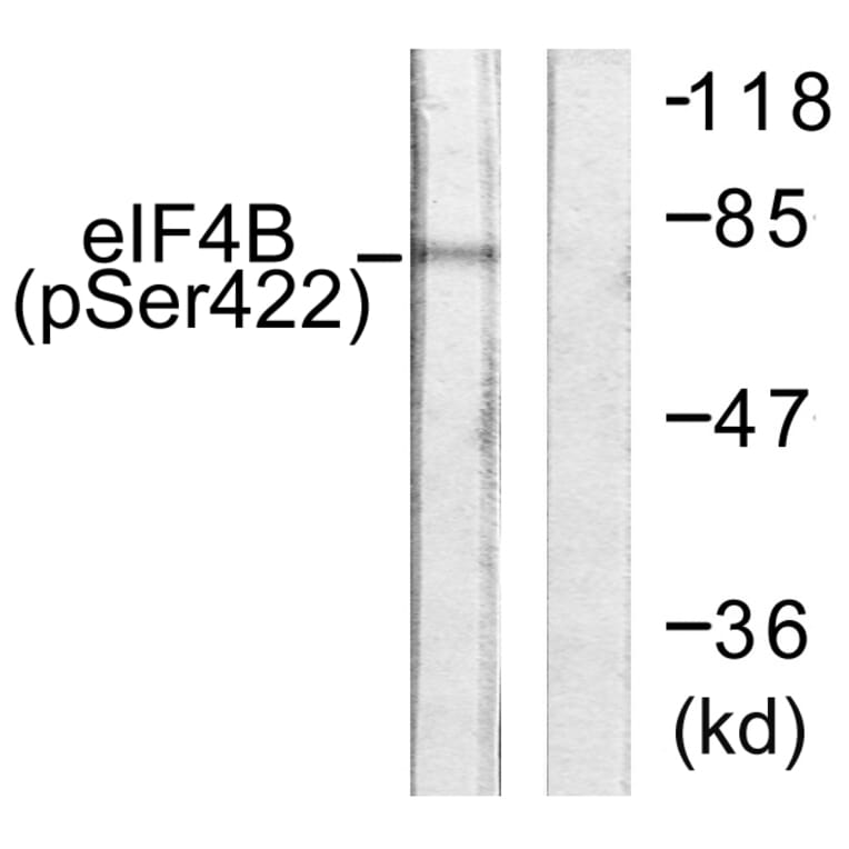 Western Blot - Anti-eIF4B (phospho Ser422) Antibody (A0641) - Antibodies.com