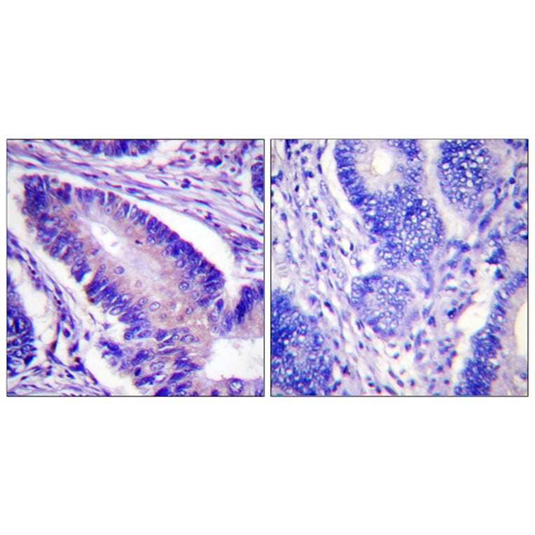 Immunohistochemistry - Anti-eIF4B (phospho Ser422) Antibody (A0641) - Antibodies.com