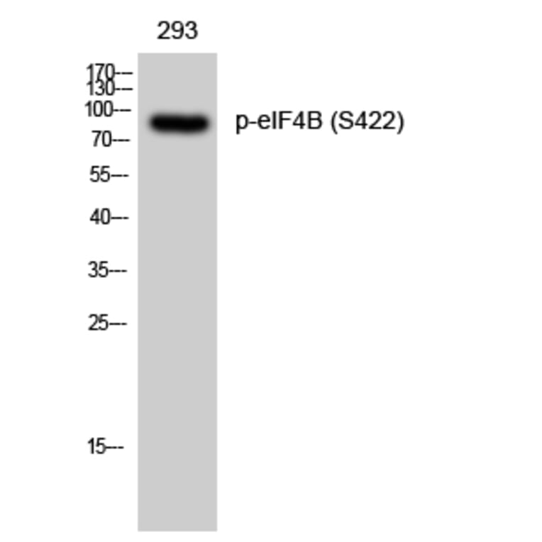 Western Blot - Anti-eIF4B (phospho Ser422) Antibody (A0641) - Antibodies.com