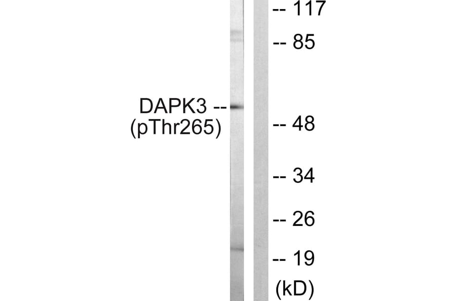 Western Blot - Anti-DAPK3 (phospho Thr265) Antibody (A0900) - Antibodies.com