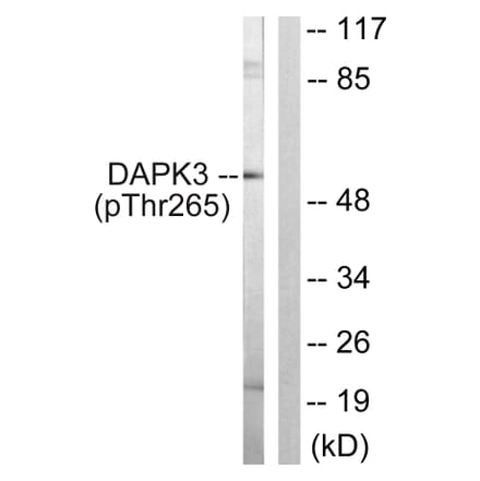 Western Blot - Anti-DAPK3 (phospho Thr265) Antibody (A0900) - Antibodies.com